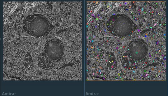2021-01-15 12_36_34-Amira - GraphBasedSegmentation_volumescope.hx